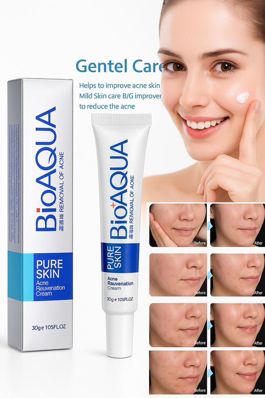 Bio aqua Acne Cream Face Skin Care Acne Anti-Wrinkle Removal Cream Spots Scar Blemish Marks 30g